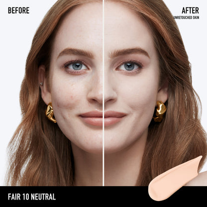 Fair 10 Neutral